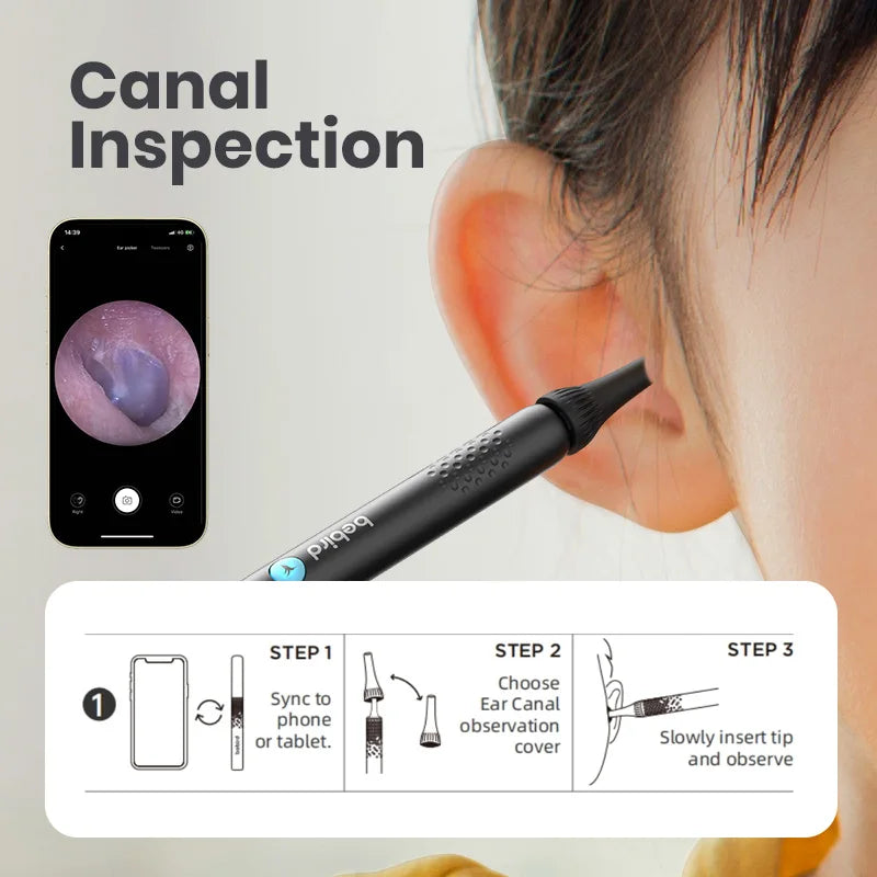 2024 Bebird ENT Observation Kit Set